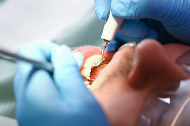 Best Broken or Chipped Tooth Repair in South Temple, PA